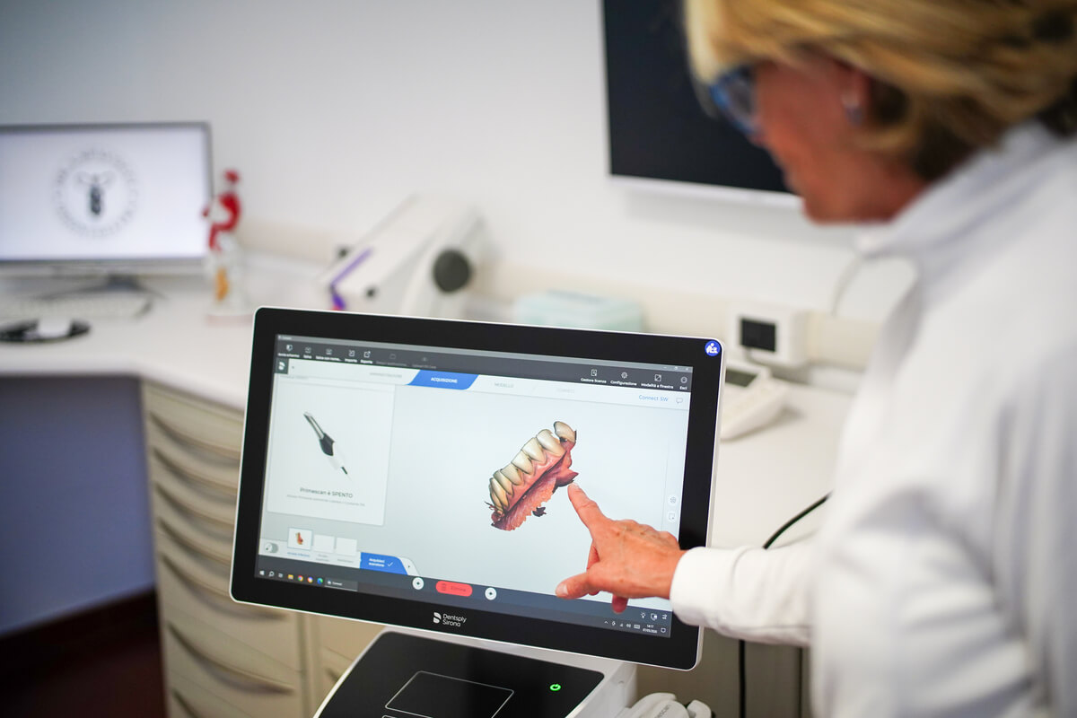Primescan intraorale Spacocci odontoiatria